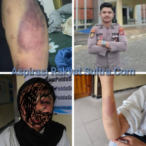 Aniayah Kekasihnya Secara Brutal Oknum Anggota Polres Konawe Utara Di Laporkan Ke Propam Polda Sultra